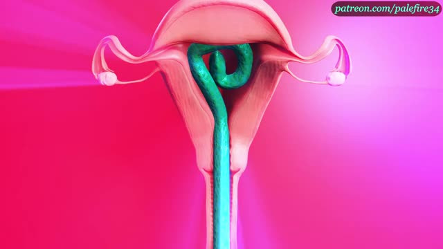 Watch Tifas tentacle hyperinflation X-ray version Shemale Porn Videos | TranSexBig.